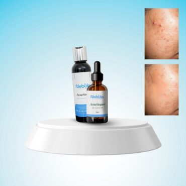 Anti Acne Combo